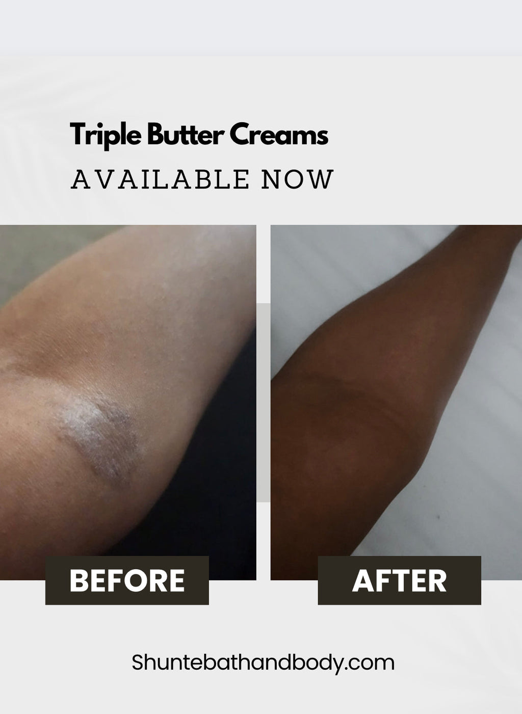 J&N Renew & Restore Butter